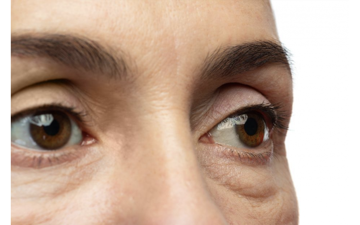 眼腫可大可少，你有機會患上傳染性急性結膜炎嗎？